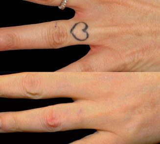 best tattoo studio in Hyderabad